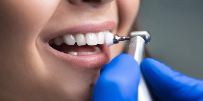 learn about cosmetic crowns from Peter Family Dentistry in Independence KY